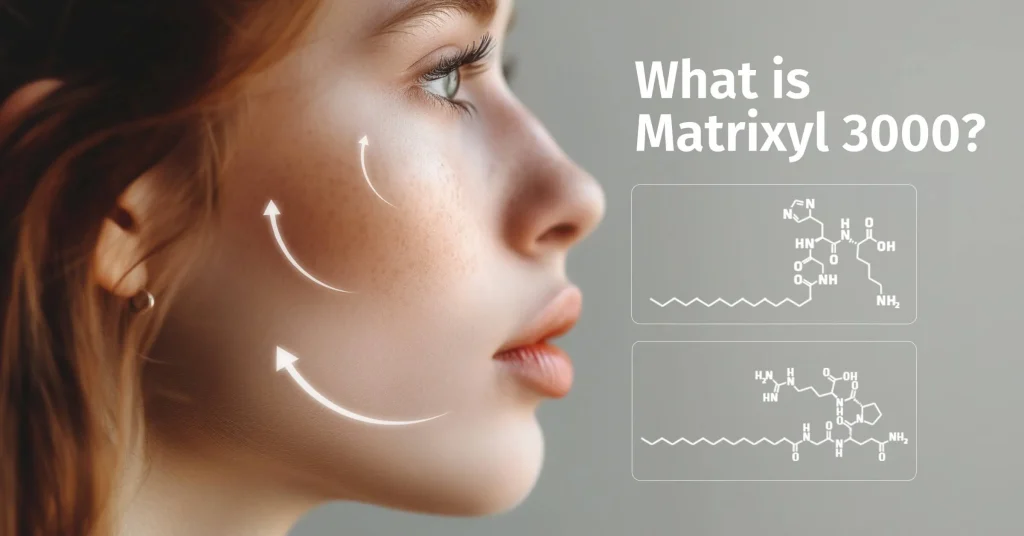 What is Matrixyl 3000