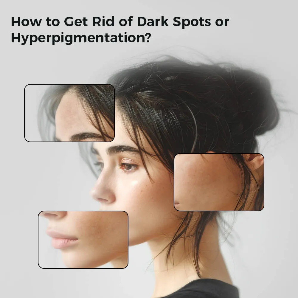 如何摆脱色素沉着