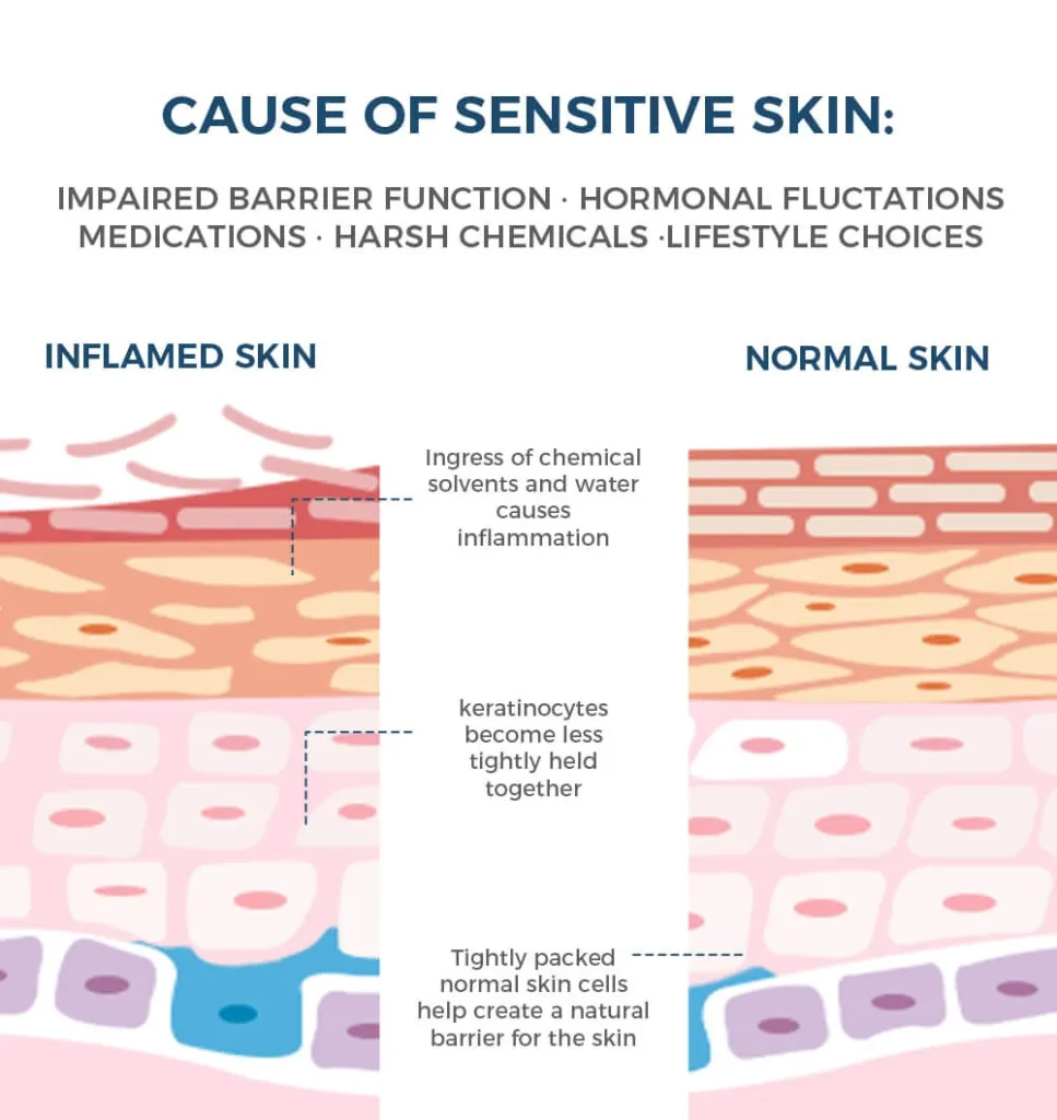 什么原因导致敏感肌肤