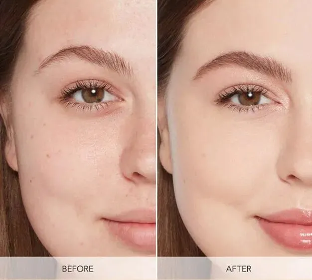 冷冻疗法面部护理前后对比