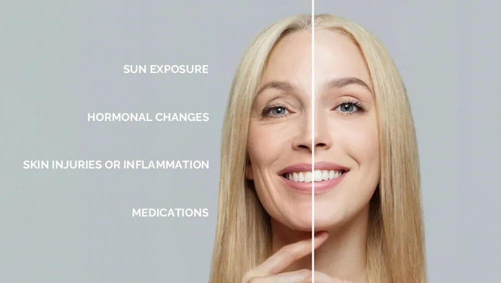 影响色素沉着的因素