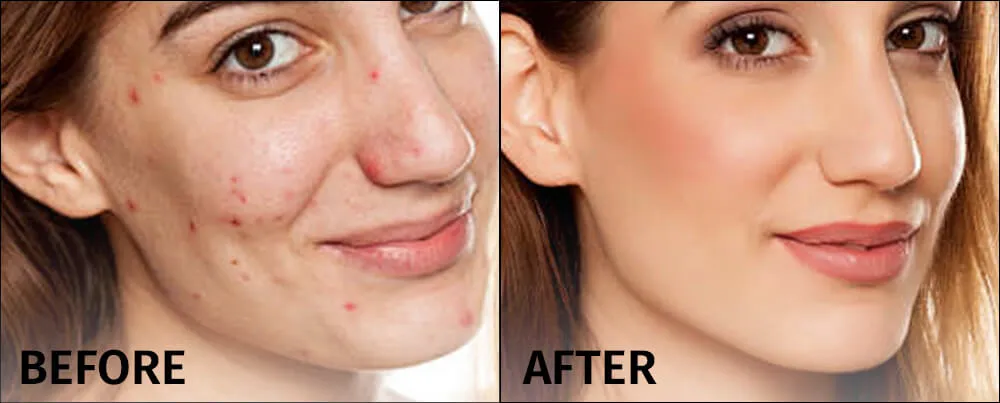 舒缓受刺激的皮肤