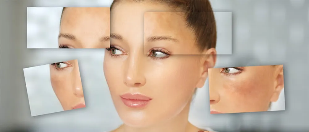 什么是色素沉着？