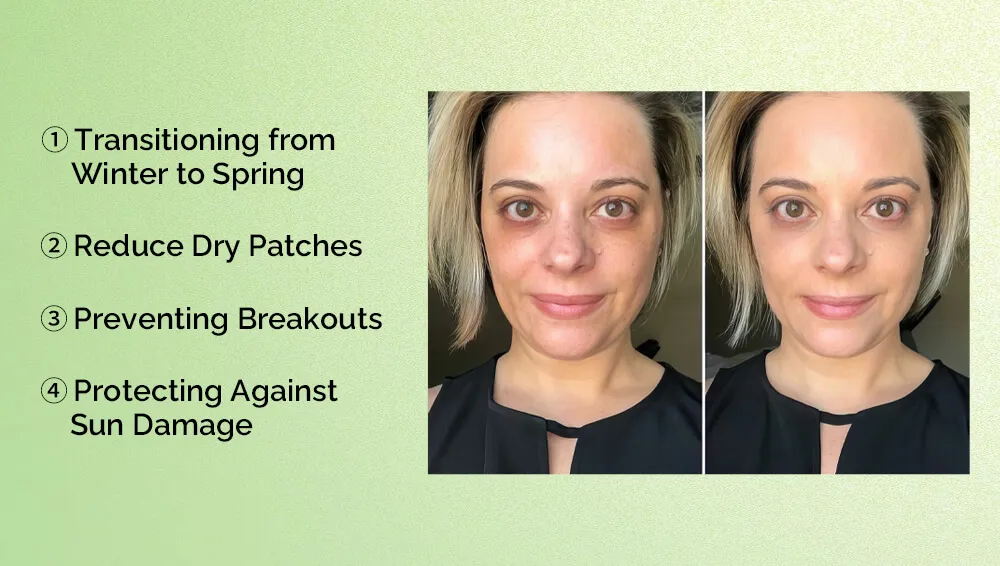 春季皮肤面临的挑战