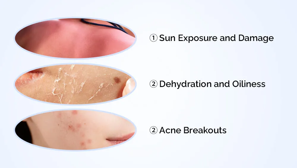 夏季的皮肤状况