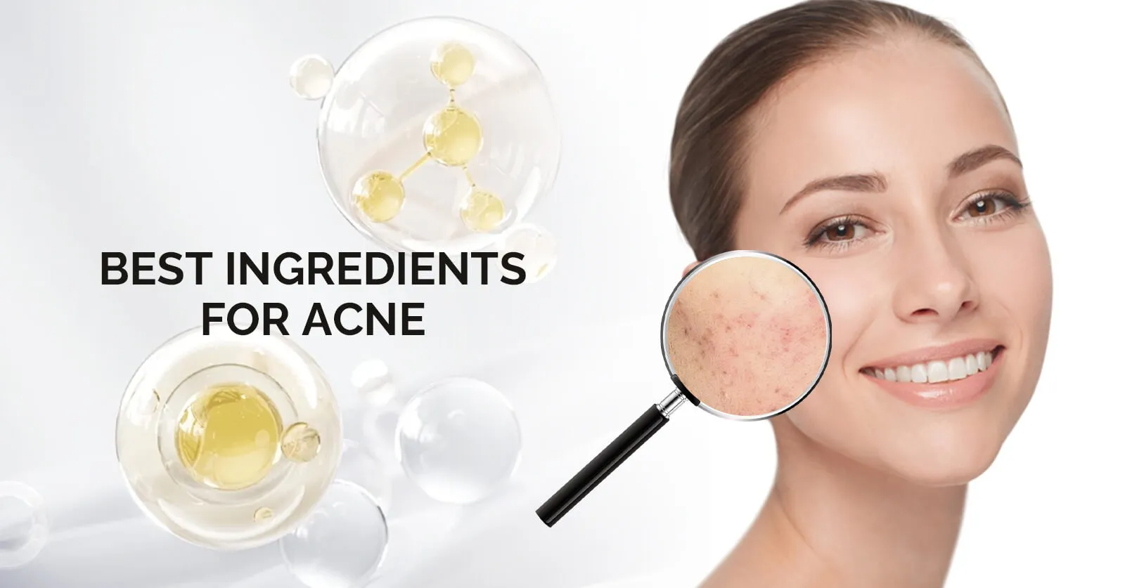 Best Ingredients For Acne