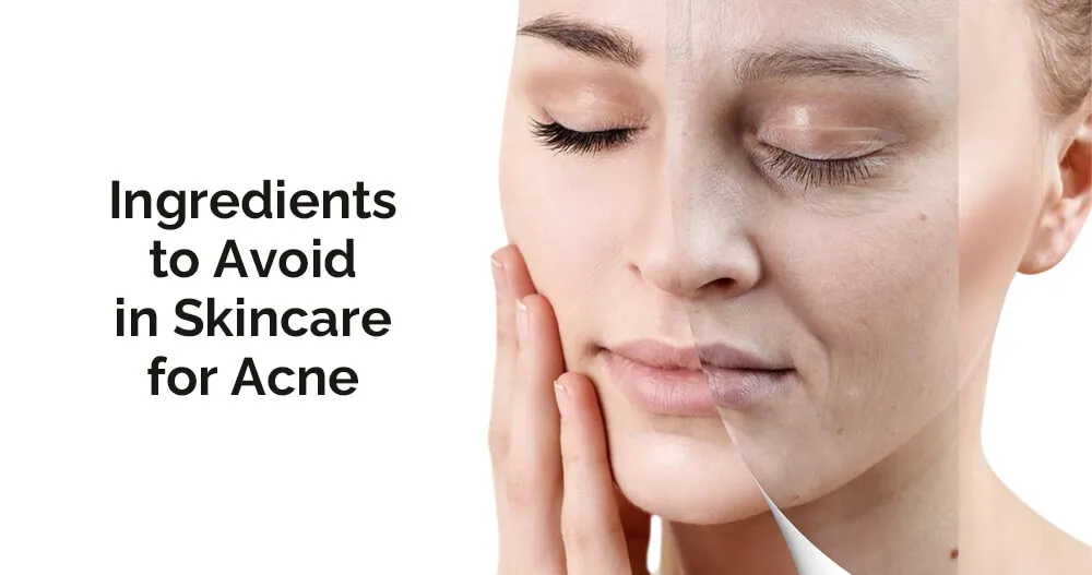 护肤中应避免的成分（针对痤疮）