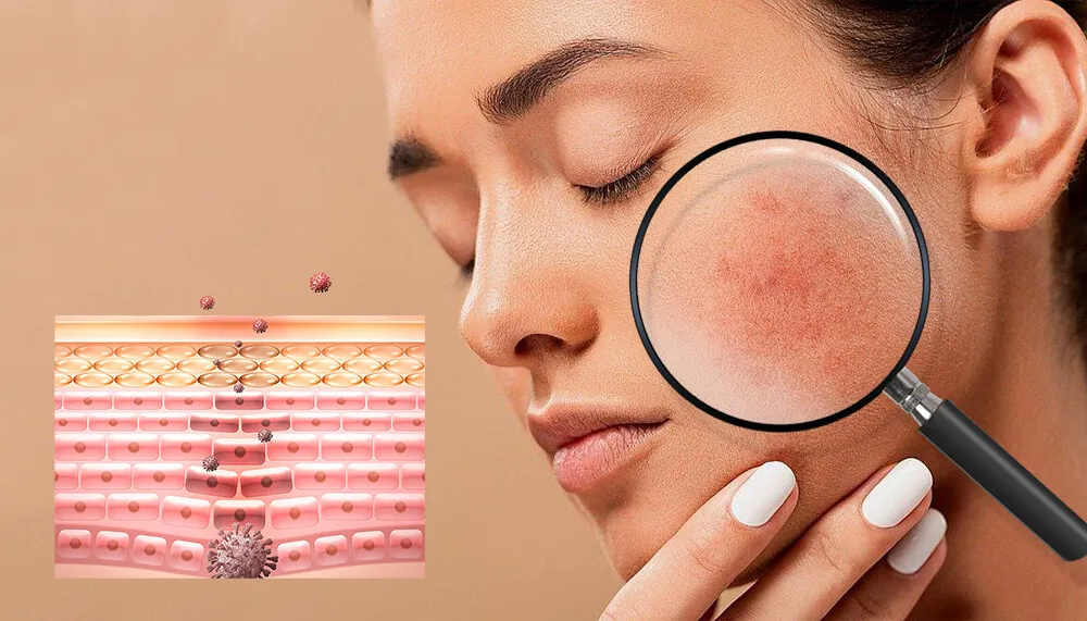 堵塞毛孔的成分