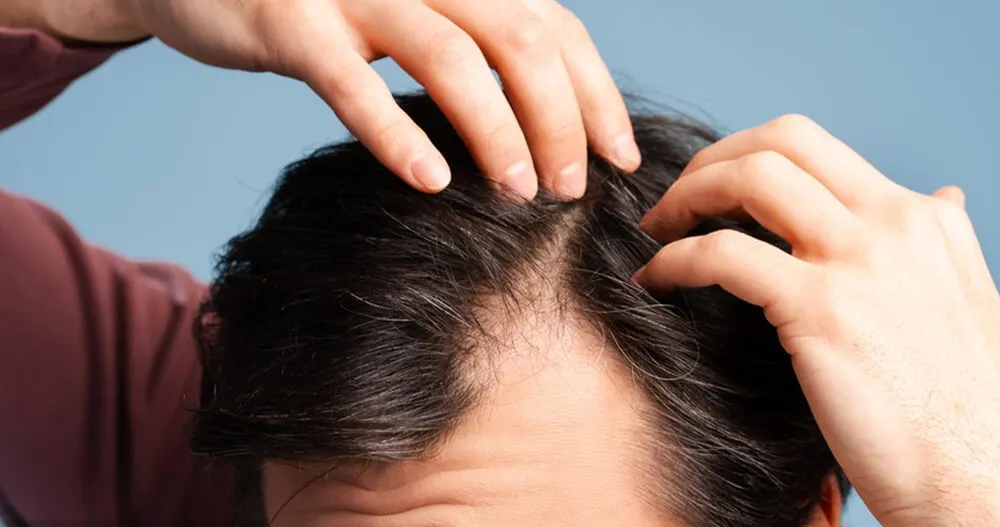 个性化头皮护理