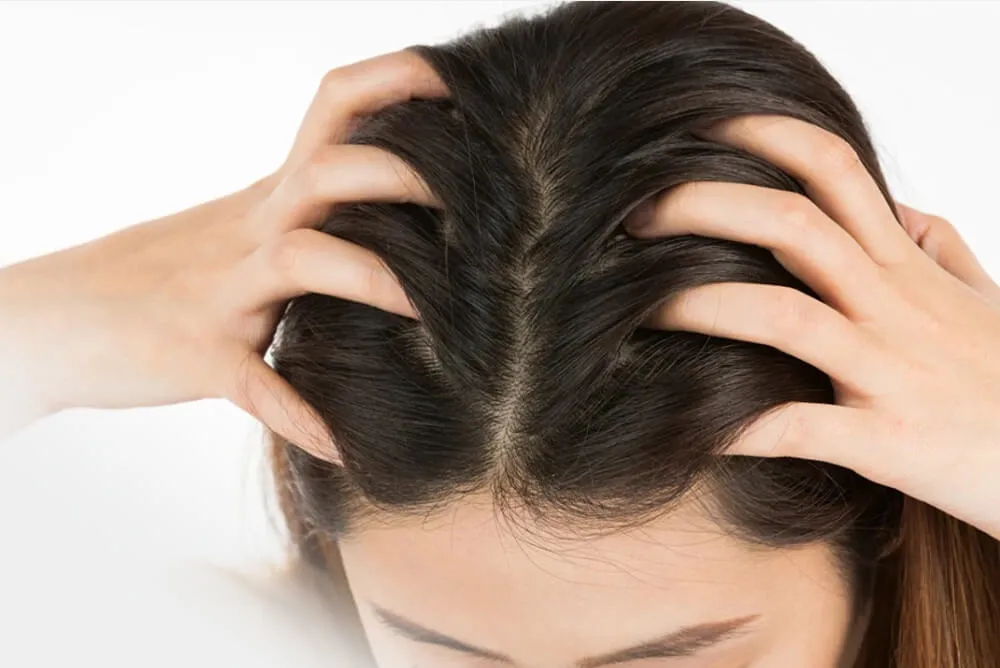 自有品牌头皮护理产品