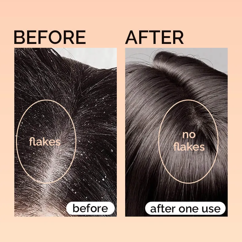 像护理皮肤一样护理头皮