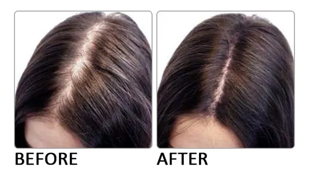 用于头发生长疗法的迷迭香水