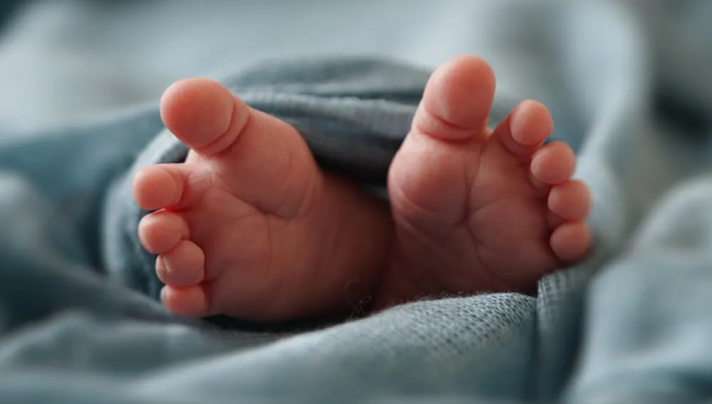 新生儿皮肤干燥