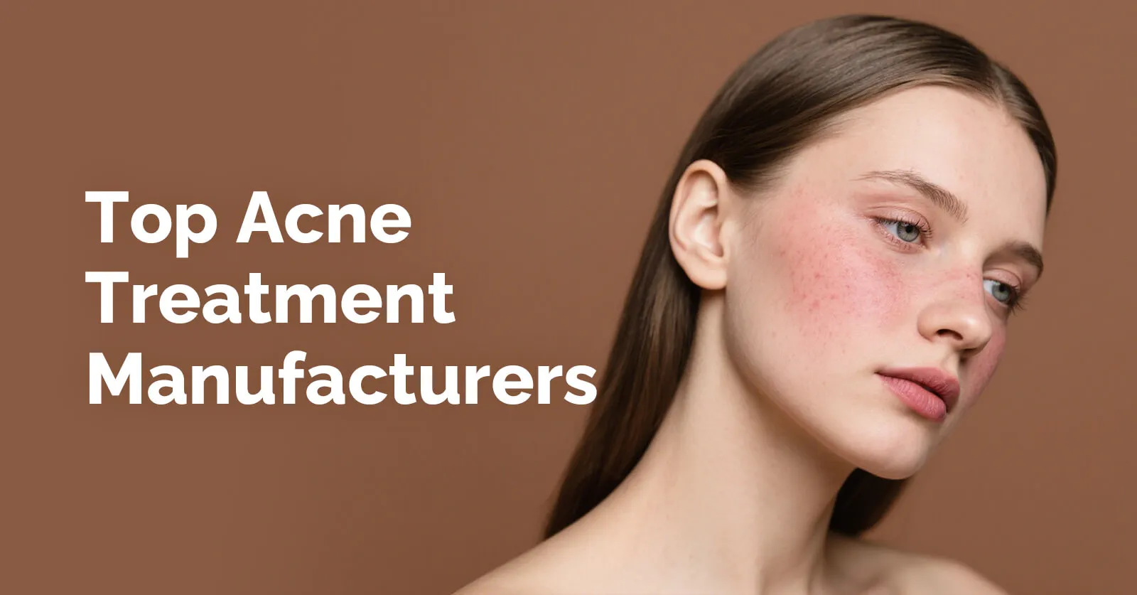 Top Acne Treatment Manufacturers