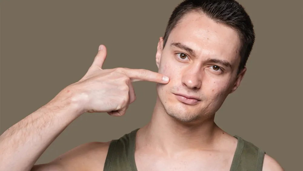 针对痤疮的靶向治疗