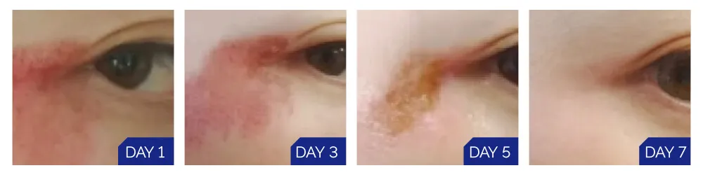 medical-dressing-case-study-picture