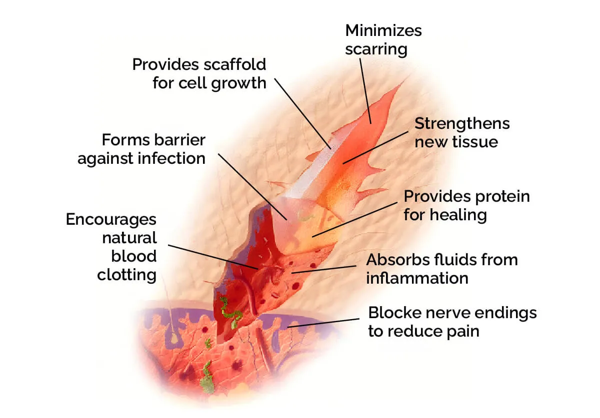 Chitosan would healing fuction