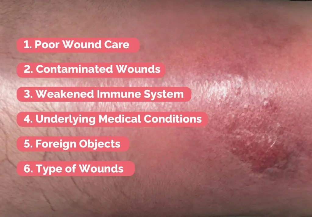 伤口感染的常见原因