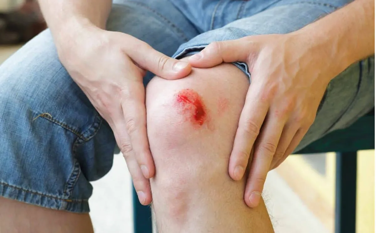 Equipment Friction Injuries