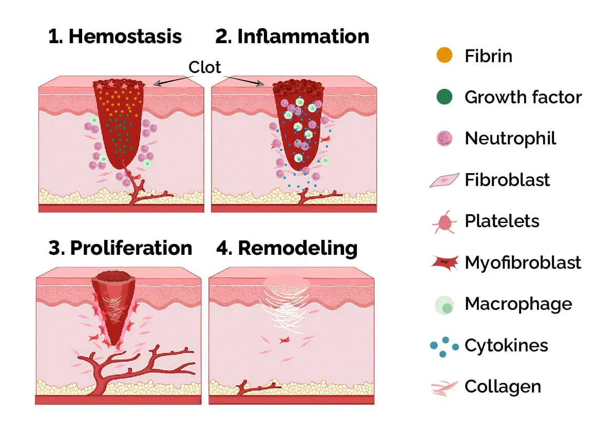 影响伤口愈合的因素