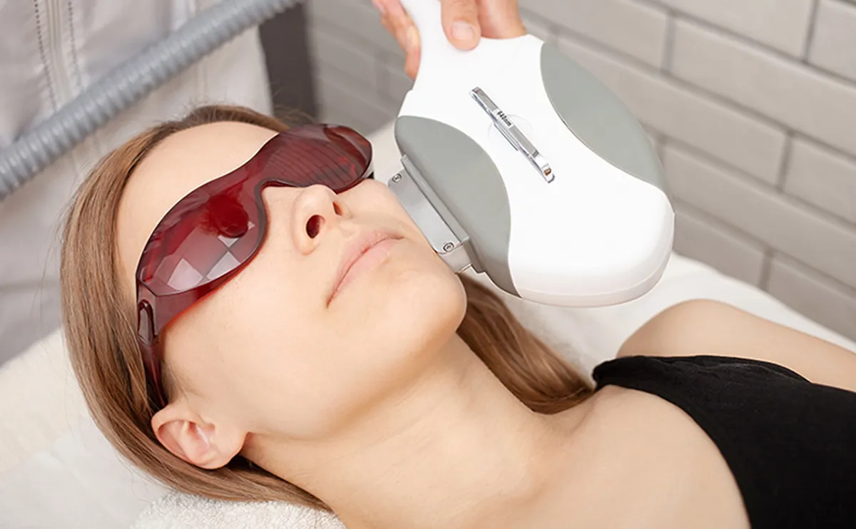 Intense Pulsed Light (IPL)