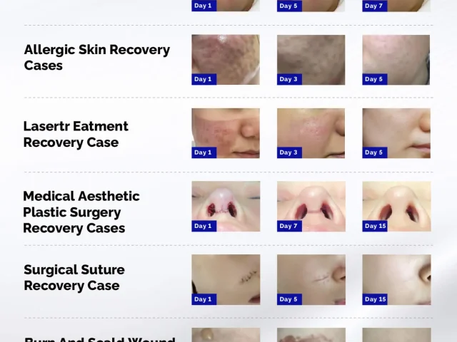 Before & After Comparison