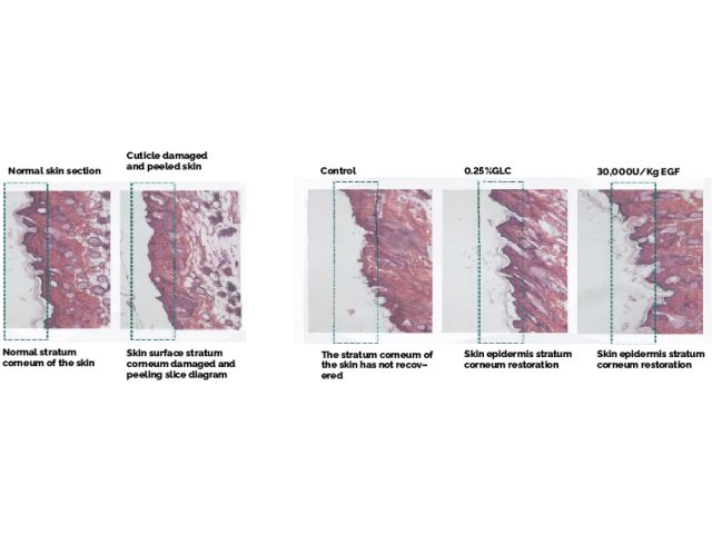GLC (Ganoderma Lucidum Chitosan) Restore damaged cuticle GLC (Ganoderma Lucidum Chitosan) Restore damaged cuticle